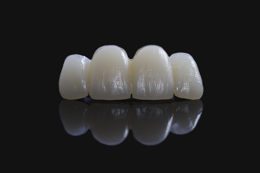 Provisional Pmma